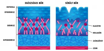 Miért fontos a kollagén peptid használata 25 éves kor után?